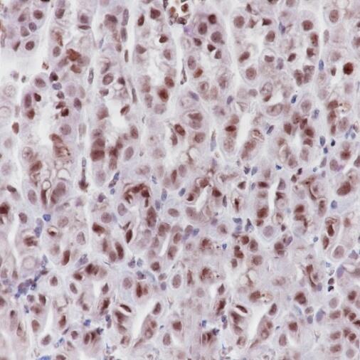 Anti-MCM2 Rabbit Monoclonal Antibody