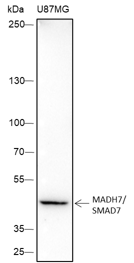 Anti-MADH7/SMAD7 Rabbit Monoclonal Antibody