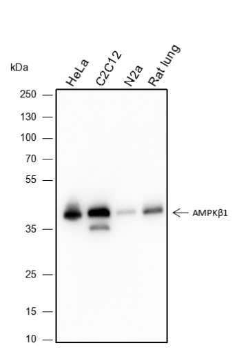 Anti-AMPK beta 1 Rabbit Monoclonal Antibody