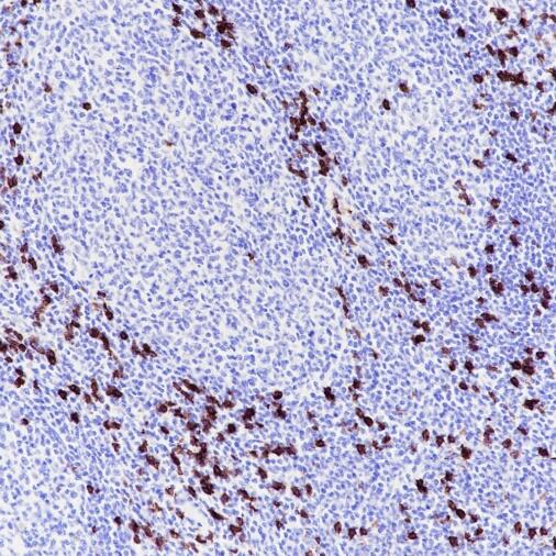 Anti-CD8 alpha Rabbit Monoclonal Antibody