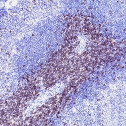 Anti-CD3 epsilon Rabbit Monoclonal Antibody