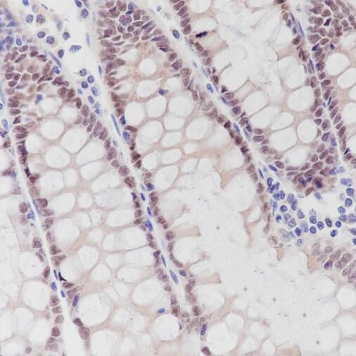 Anti-CDX2 Rabbit Monoclonal Antibody