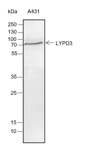Anti-C4.4A/LYPD3 Rabbit Monoclonal Antibody
