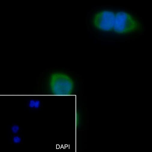Anti-C4.4A/LYPD3 Rabbit Monoclonal Antibody