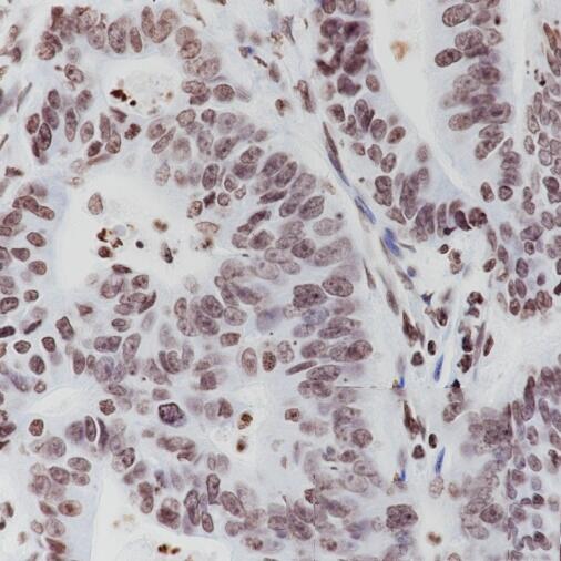 Anti-ERCC1 Rabbit Monoclonal Antibody
