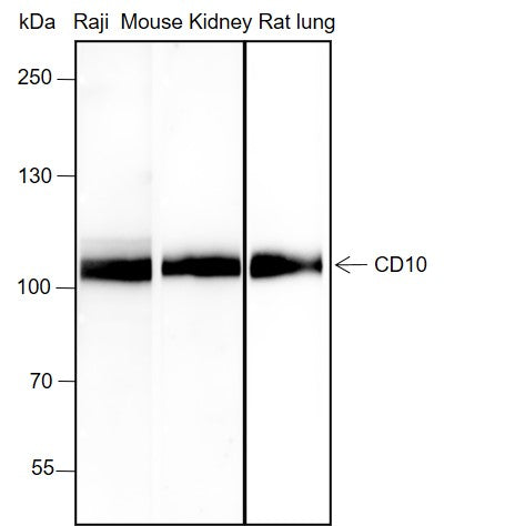 Anti-CD10 Rabbit Monoclonal Antibody