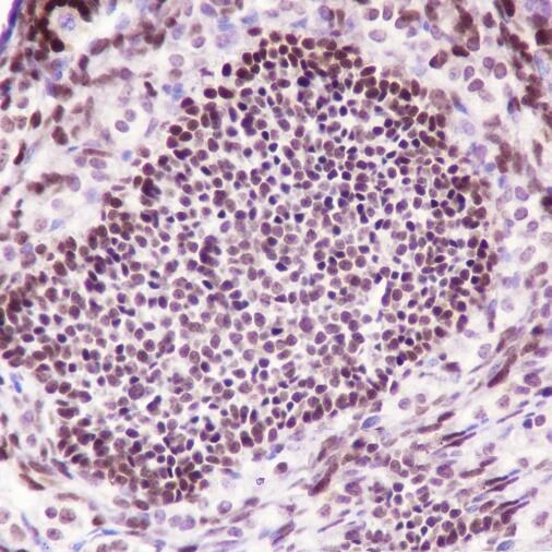 Anti-FOXL2 Rabbit Monoclonal Antibody