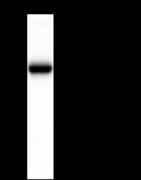 Anti-AFP Rabbit Monoclonal Antibody