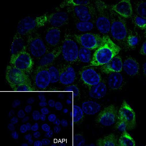 Anti-AFP Rabbit Monoclonal Antibody