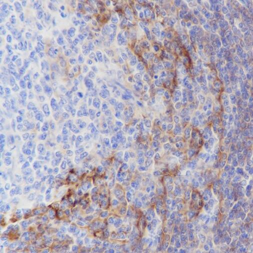 Anti-CD23 Rabbit Monoclonal Antibody