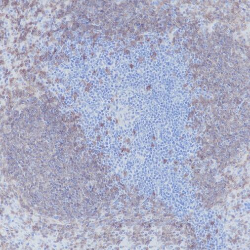 Anti-CD20 Rabbit Monoclonal Antibody