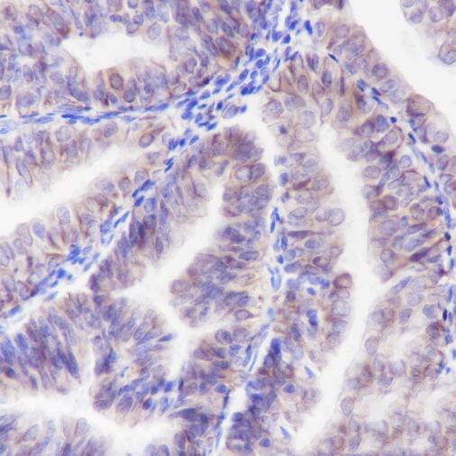 Anti-ALOX15 Rabbit Monoclonal Antibody