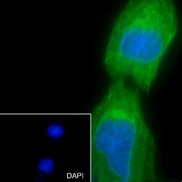 Anti-Keratin 15 Rabbit Monoclonal Antibody