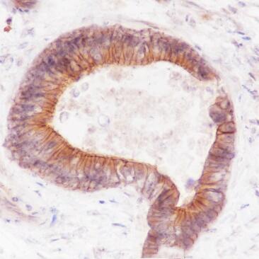 Anti-FGFR2 Rabbit Monoclonal Antibody