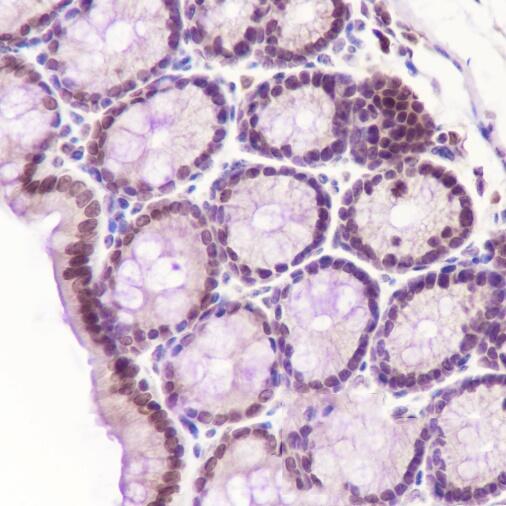 Anti-CDK8 Rabbit Monoclonal Antibody