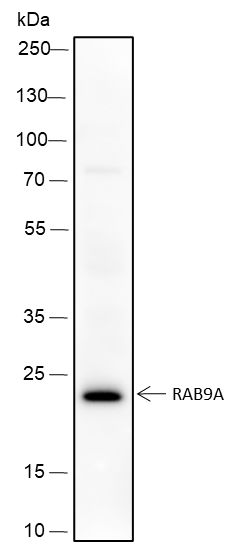 Anti-RAB9A Rabbit Monoclonal Antibody