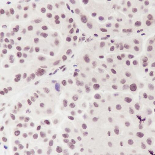 Anti-Ataxin 3 Rabbit Monoclonal Antibody
