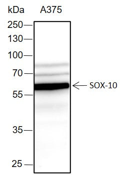 Anti-SOX10 Rabbit Monoclonal Antibody
