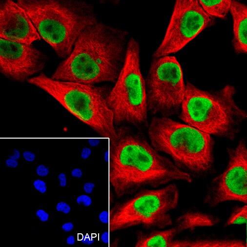 Anti-SOX10 Rabbit Monoclonal Antibody