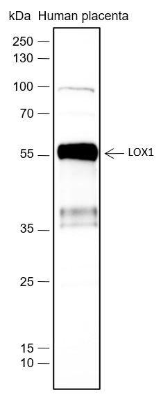 Anti-LOX1 Rabbit Monoclonal Antibody