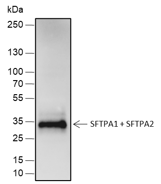 Anti-SFTPA1 + SFTPA2 Rabbit Monoclonal Antibody