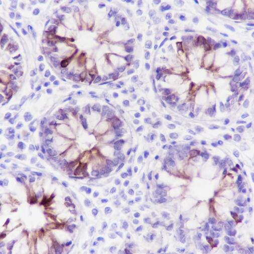 Anti-MUC-4 Rabbit Monoclonal Antibody