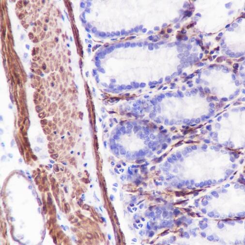 Anti-Caldesmon/CDM Rabbit Monoclonal Antibody