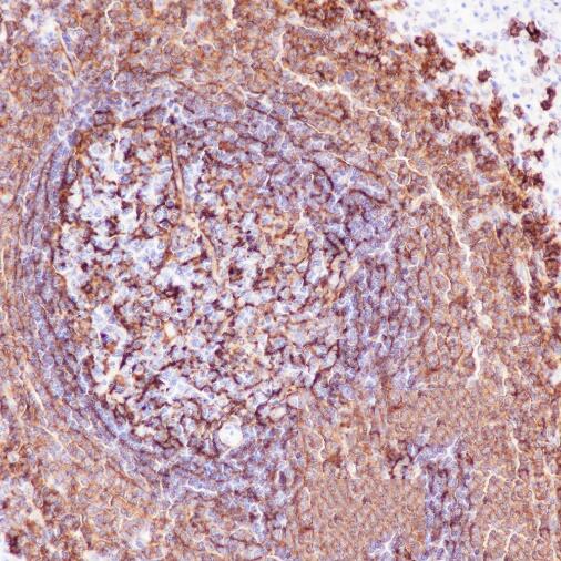 Anti-CD21 Rabbit Monoclonal Antibody