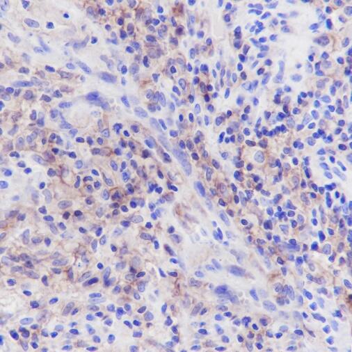 Anti-CD33 Rabbit Monoclonal Antibody