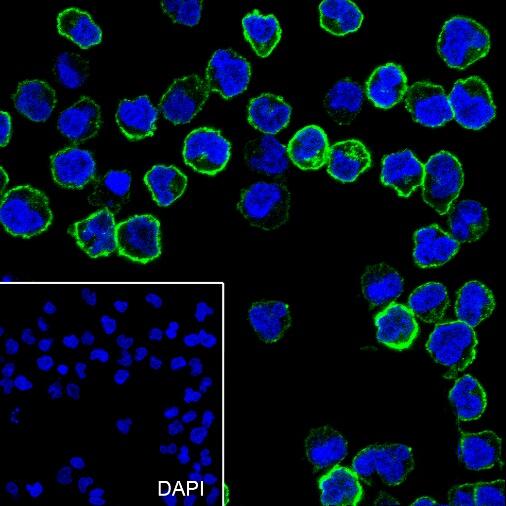 Anti-CD38 Rabbit Monoclonal Antibody