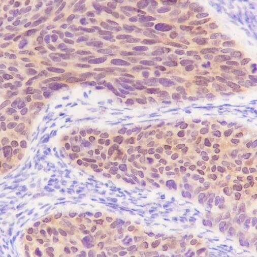 Anti-S100A2 Rabbit Monoclonal Antibody