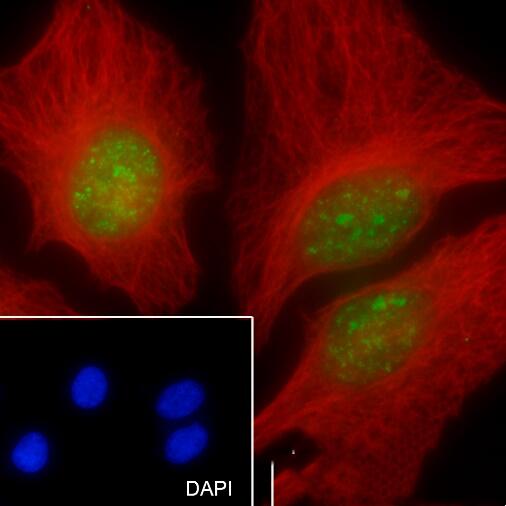 Anti-MCM5 Rabbit Monoclonal Antibody