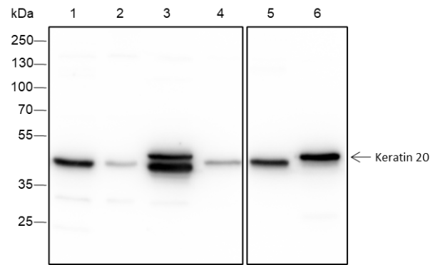 Anti-Keratin 20 Rabbit Monoclonal Antibody