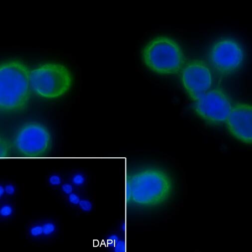 Anti-Keratin 20 Rabbit Monoclonal Antibody