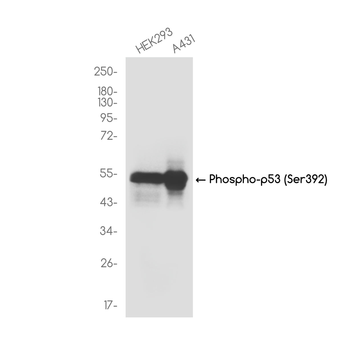 Anti-Phospho-p53 (Ser392) Rabbit Monoclonal Antibody