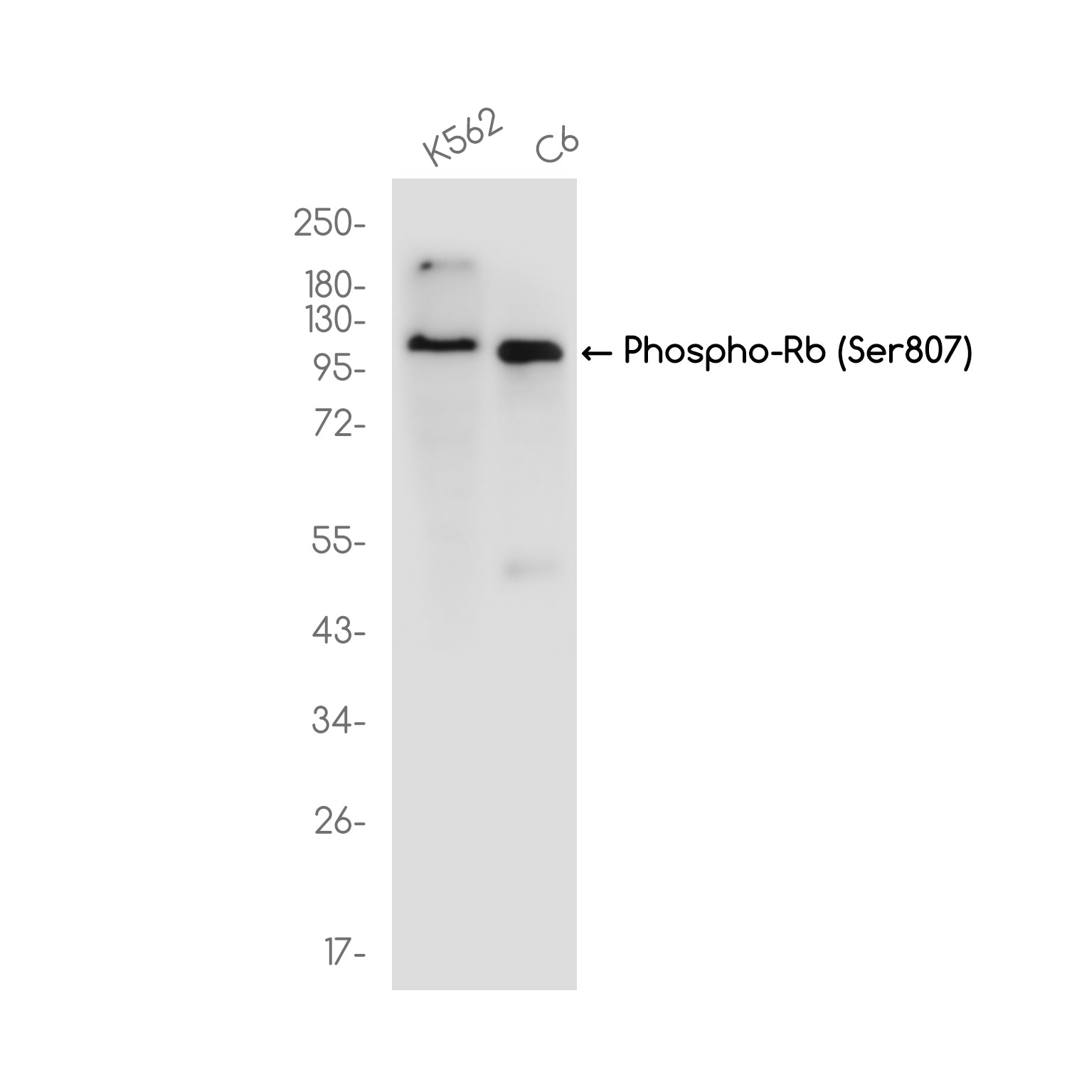 Anti-Phospho-Rb (Ser807)  Rabbit Monoclonal Antibody