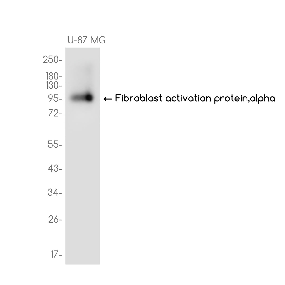Anti-Fibroblast activation protein,alpha Rabbit Monoclonal Antibody