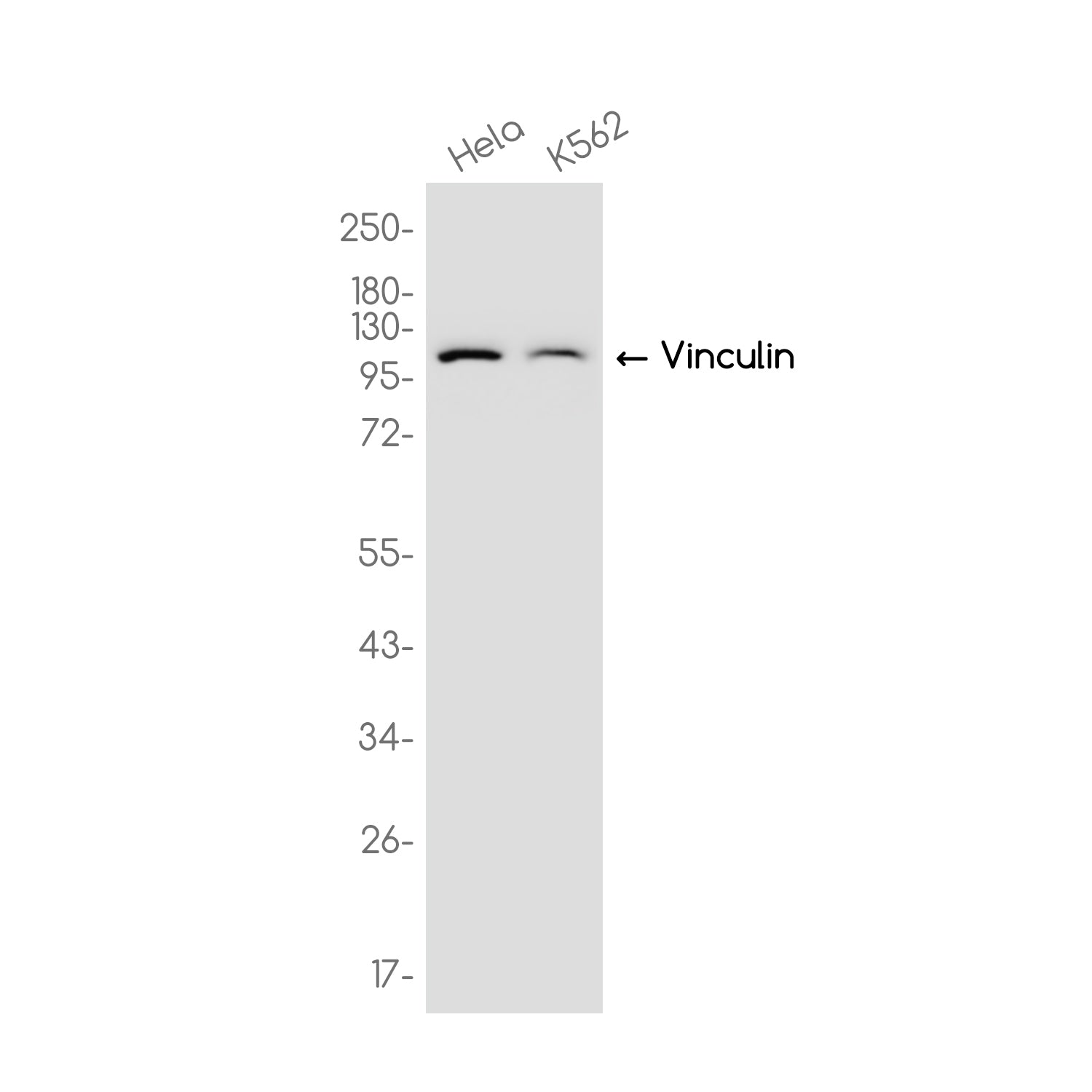 Anti-Vinculin Rabbit Monoclonal Antibody