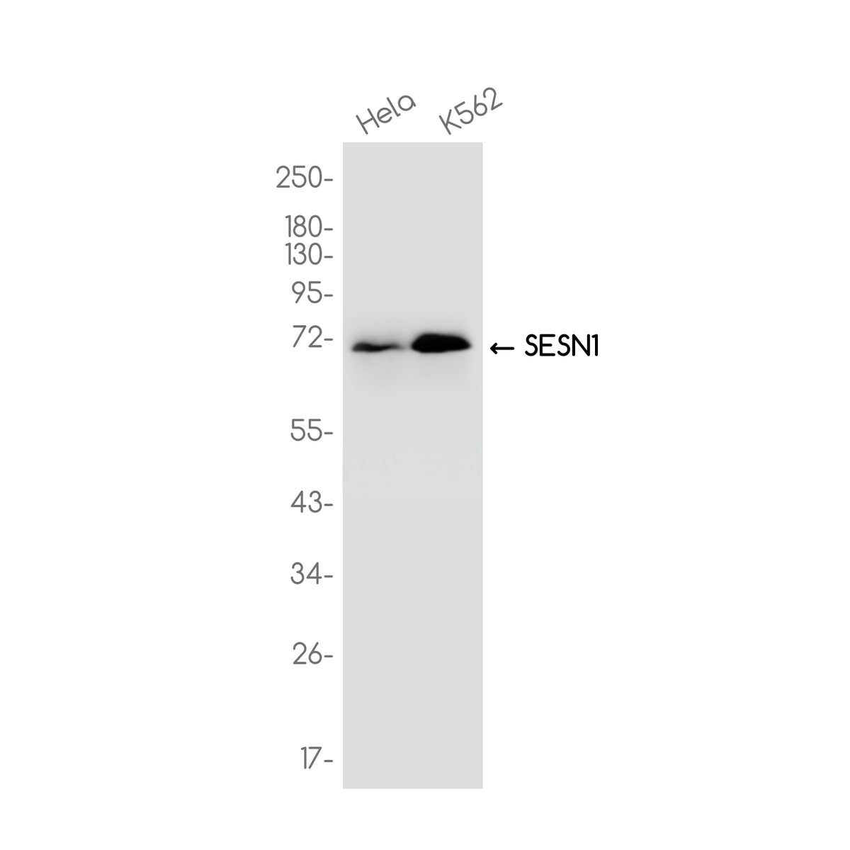Anti-SESN1 Rabbit Monoclonal Antibody
