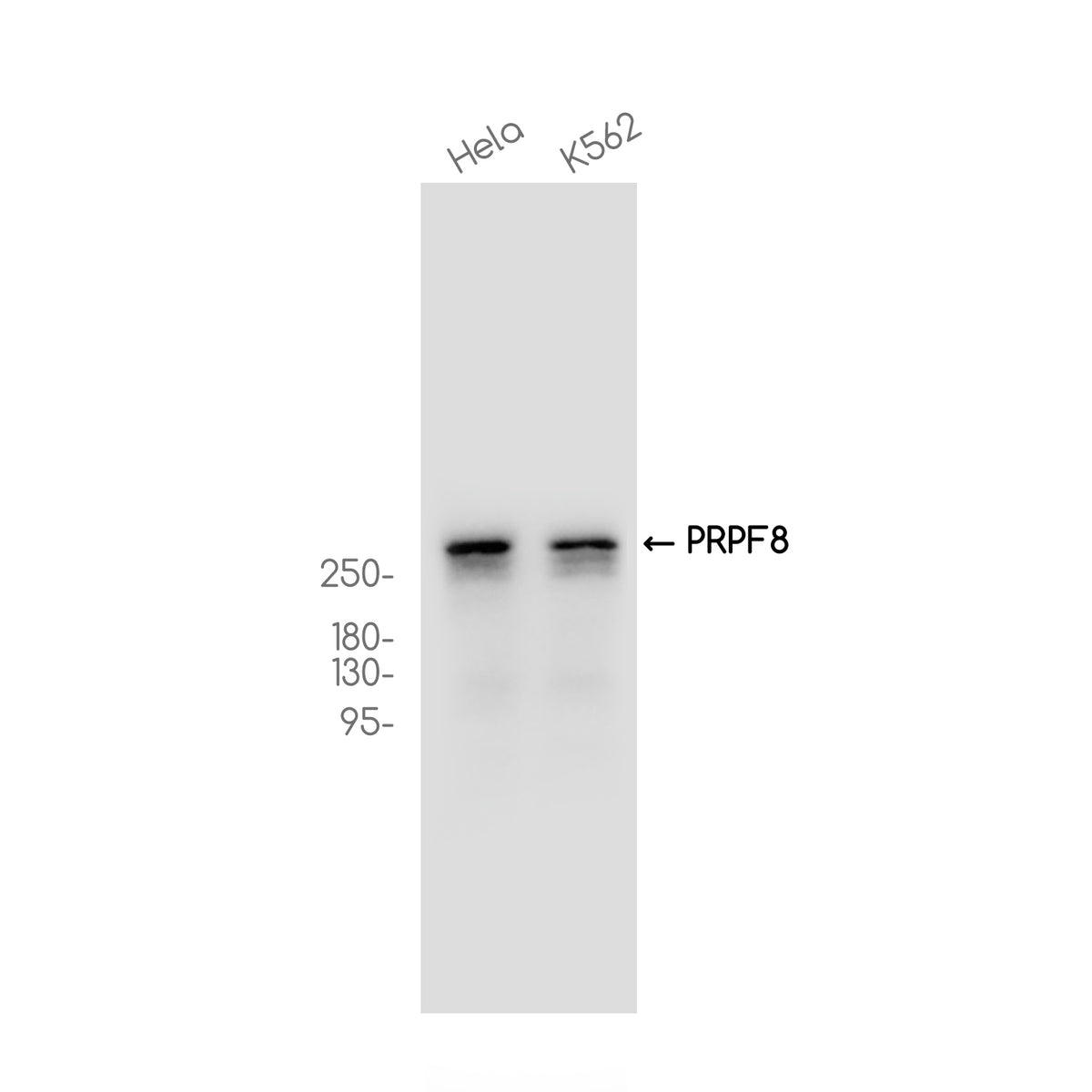 Anti-PRPF8 Rabbit Monoclonal Antibody