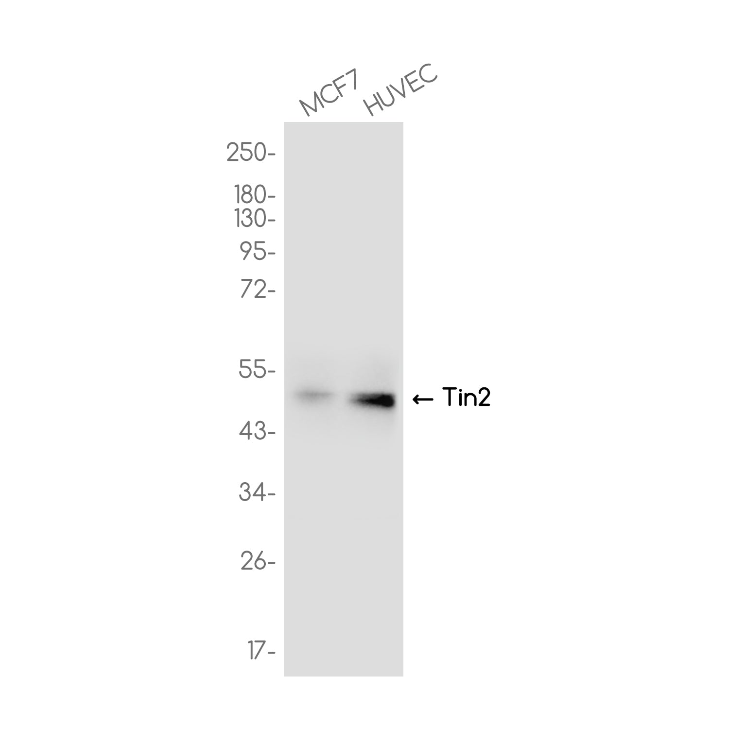 Anti-TINF2 Rabbit Monoclonal Antibody