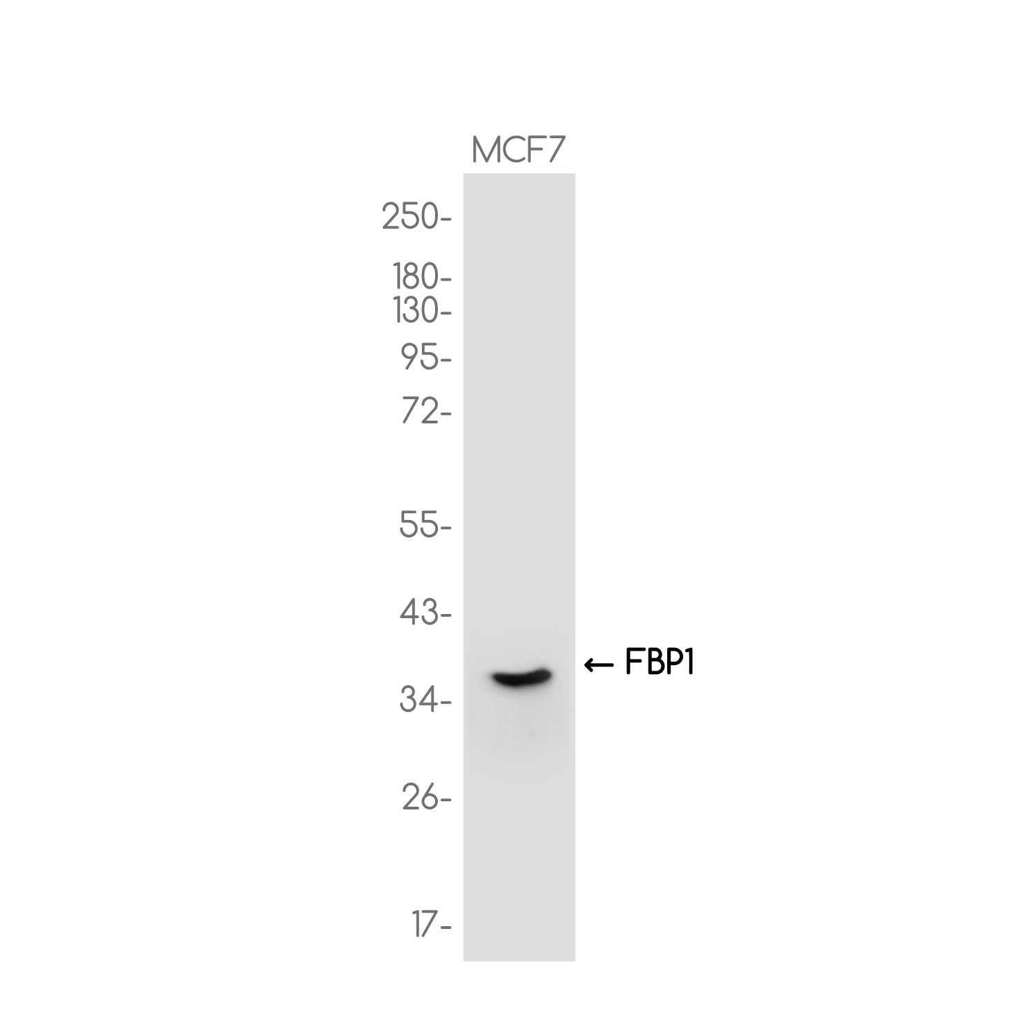 Anti-FBP1 Rabbit Monoclonal Antibody