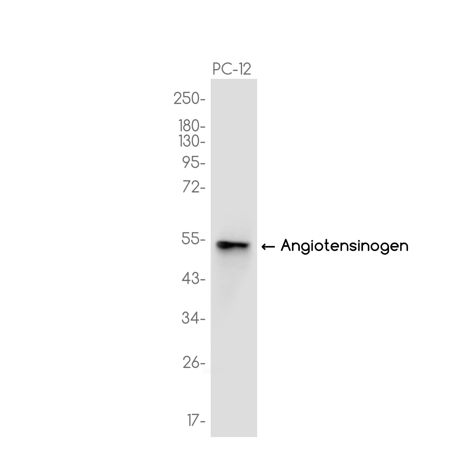 Anti-Angiotensinogen Rabbit Monoclonal Antibody