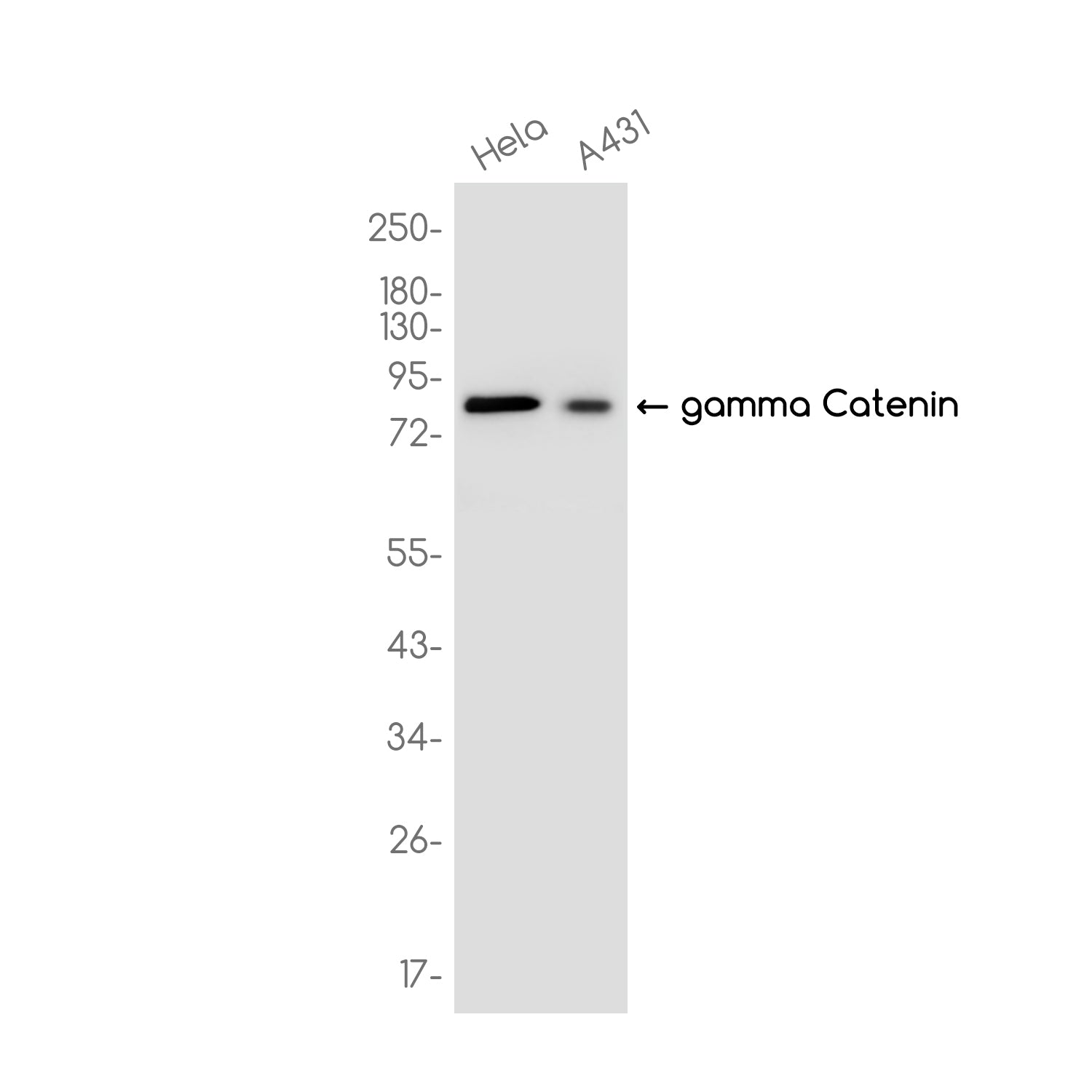 Anti-gamma Catenin Rabbit Monoclonal Antibody