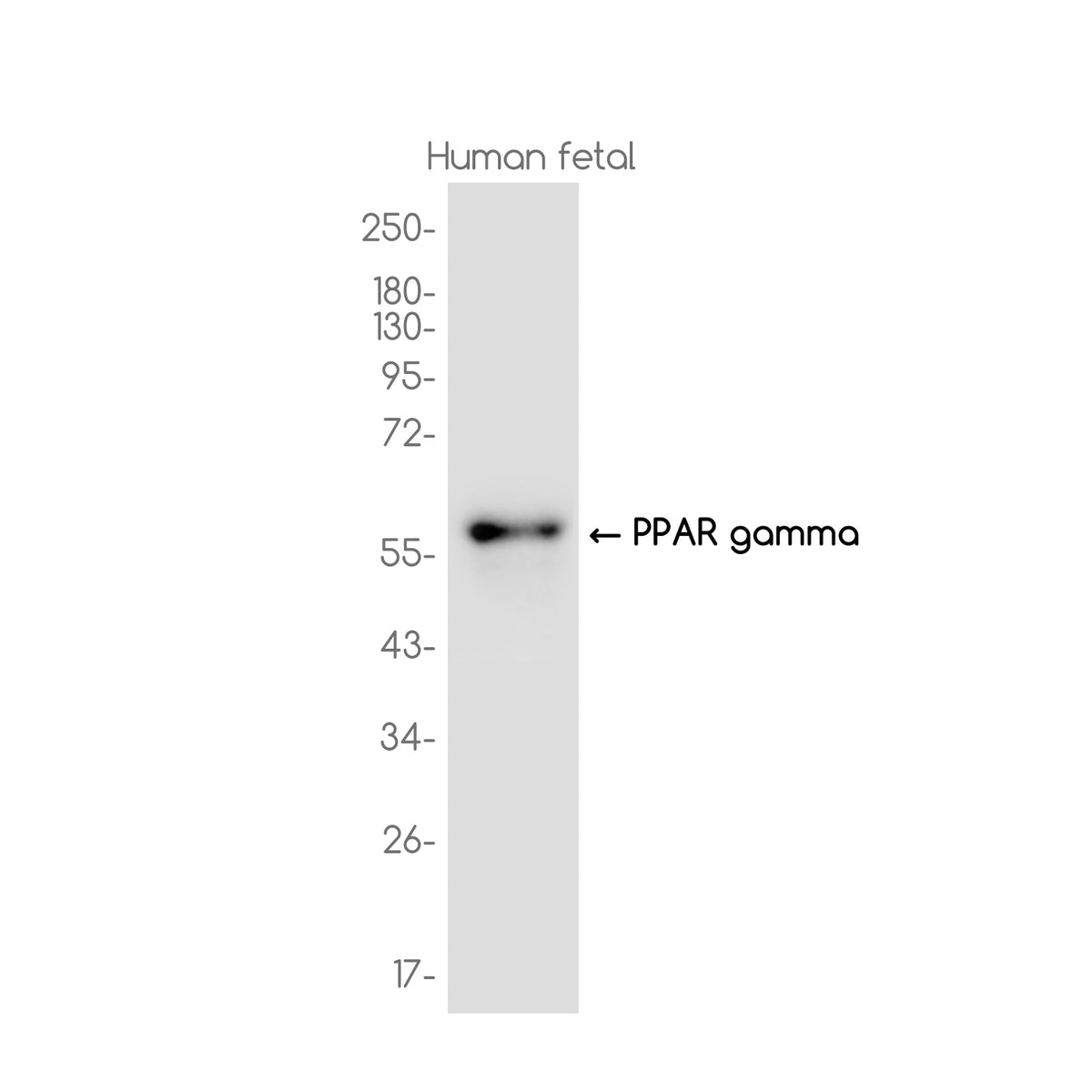 Anti-PPAR gamma Rabbit Monoclonal Antibody