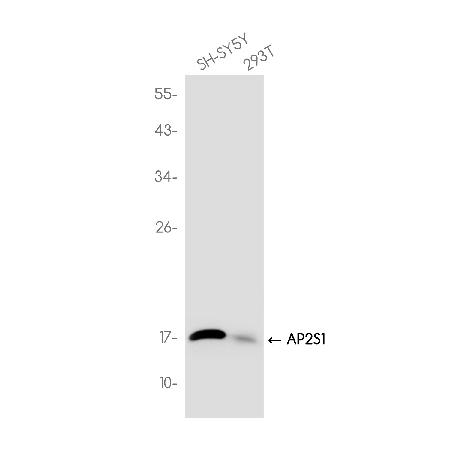 Anti-AP2S1 Rabbit Monoclonal Antibody