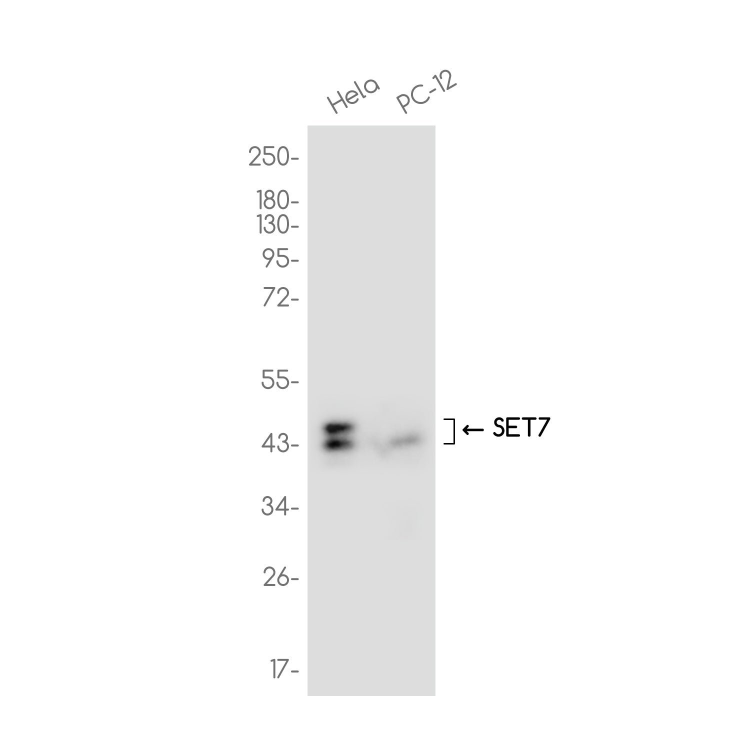 Anti-SETD7 Rabbit Monoclonal Antibody