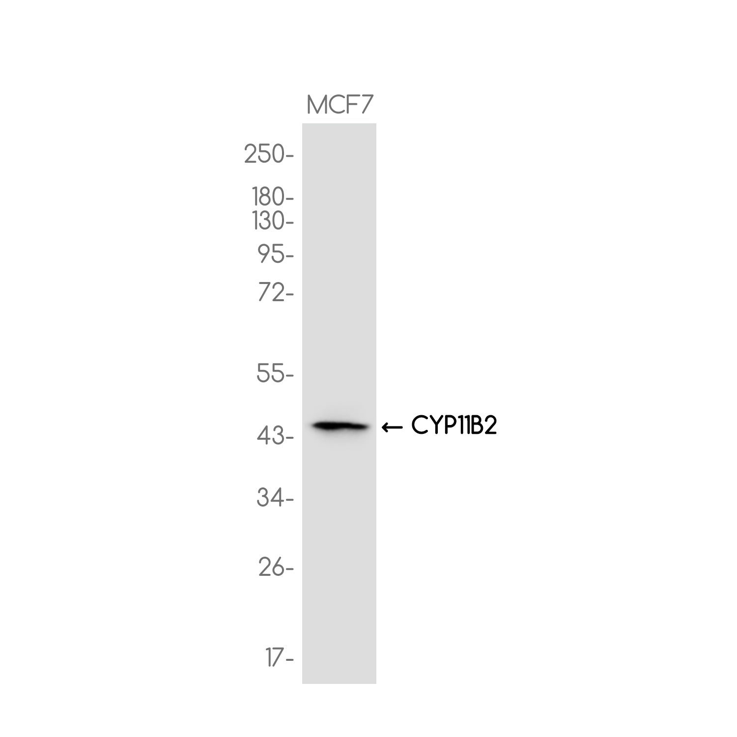 Anti-CYP11B2 Rabbit Monoclonal Antibody