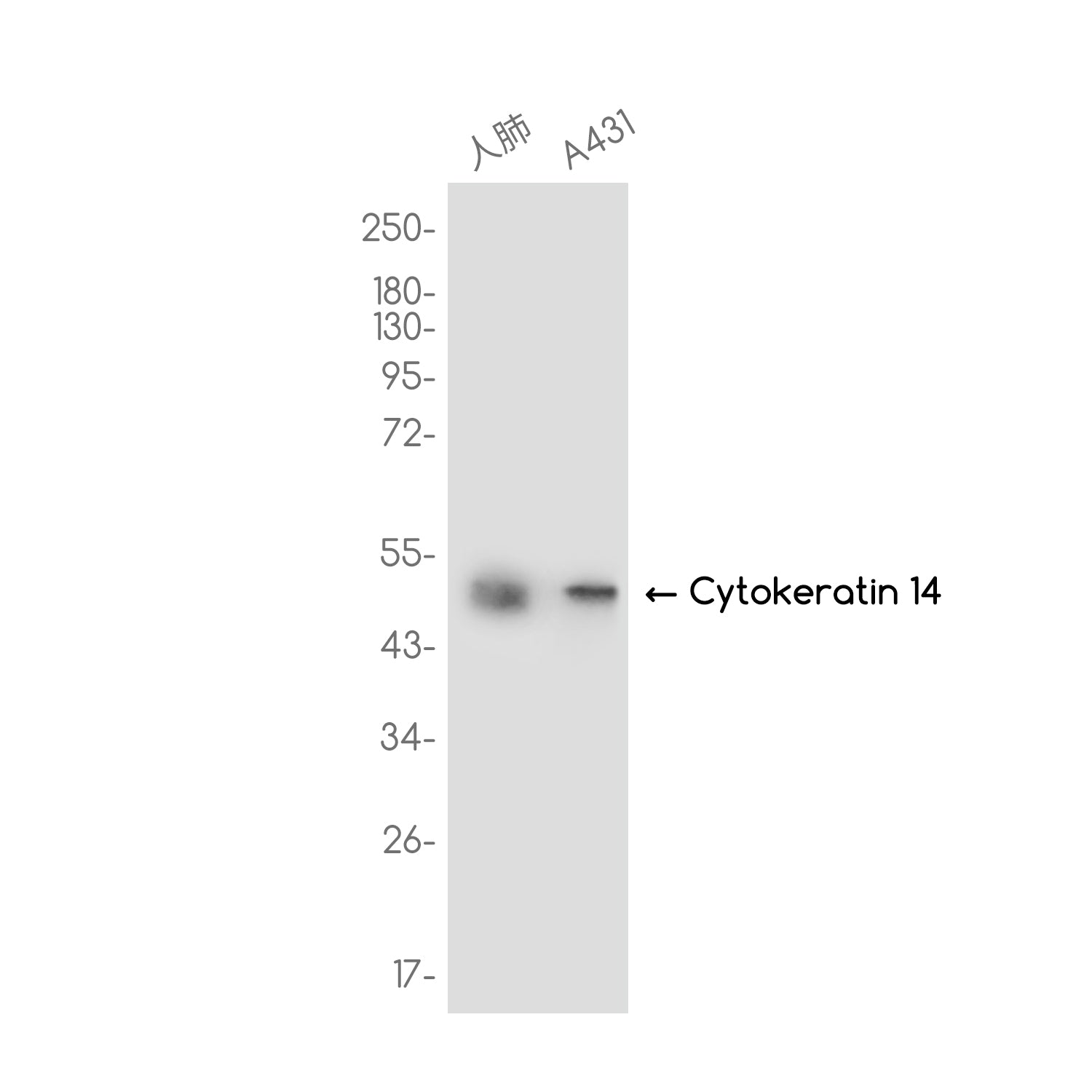 Anti-Cytokeratin 14 Rabbit Monoclonal Antibody