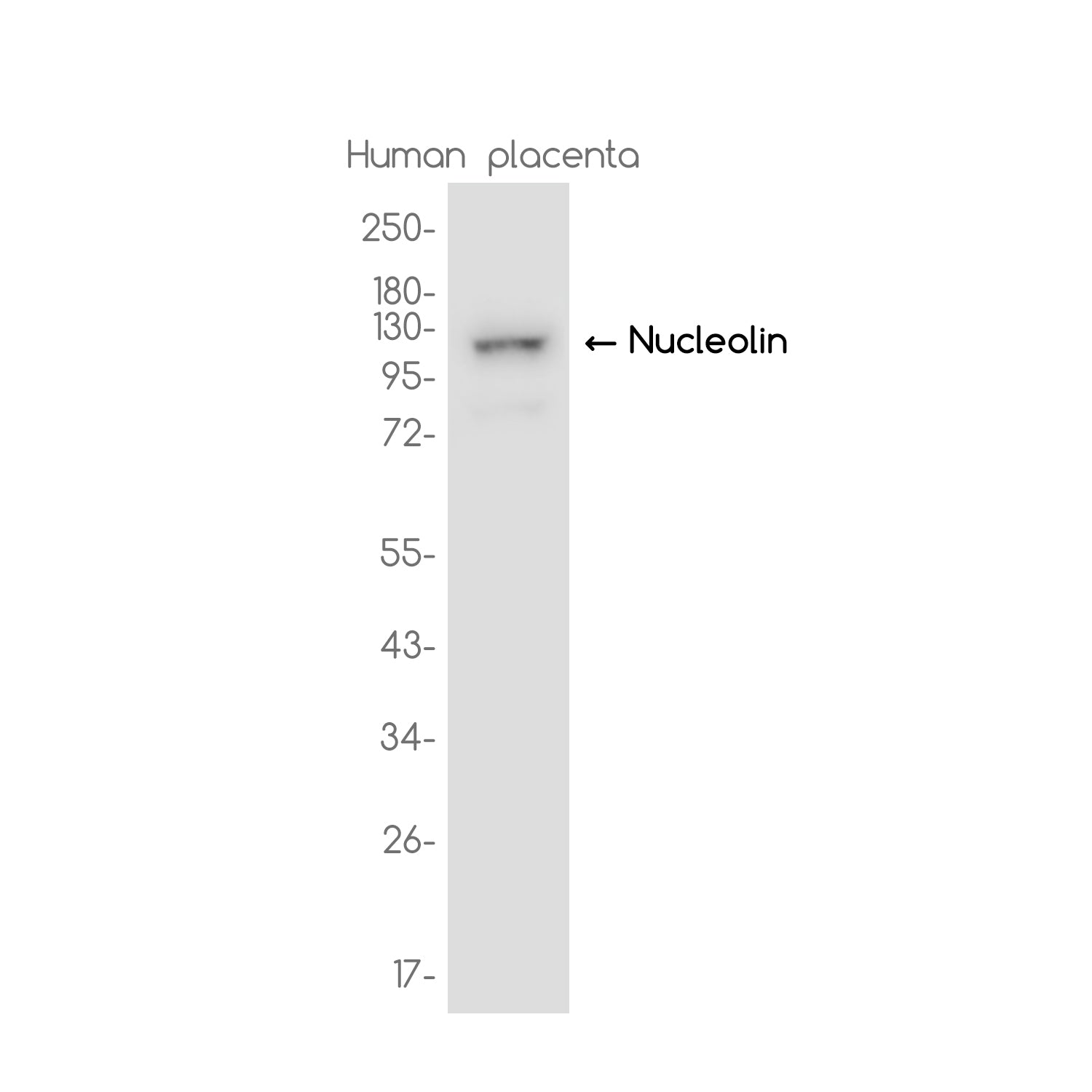 Anti-Nucleolin Rabbit Monoclonal Antibody